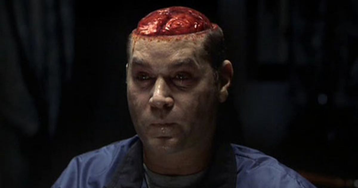 Ray Liotta has no scalp and his brain is showing in Hannibal 