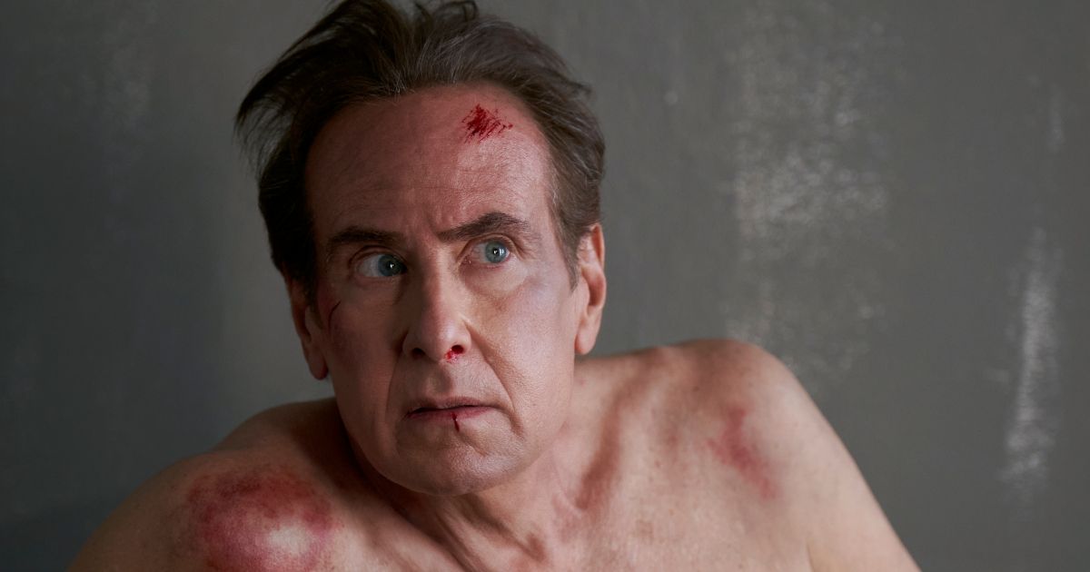 Paul T Goldman bruised in Peacock TV show from Justin Woliner