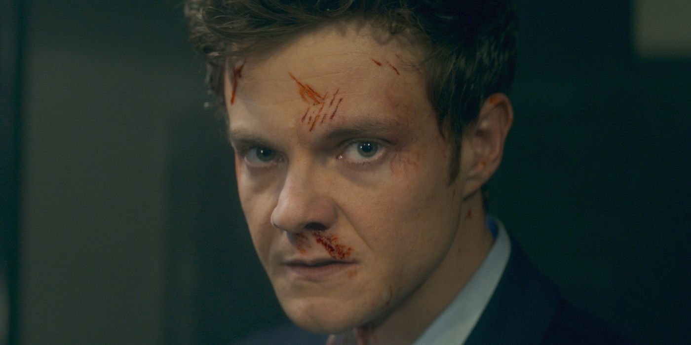 Jack Quaid's bloody and bruised face in the 2025 movie Novocaine