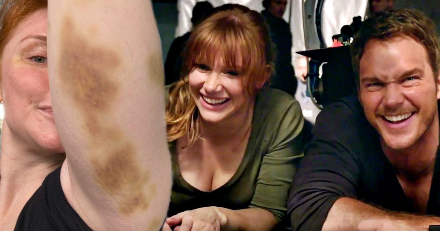 Bryce Dallas Howard Shows Off Nasty Bruises from Jurassic World 3 Set