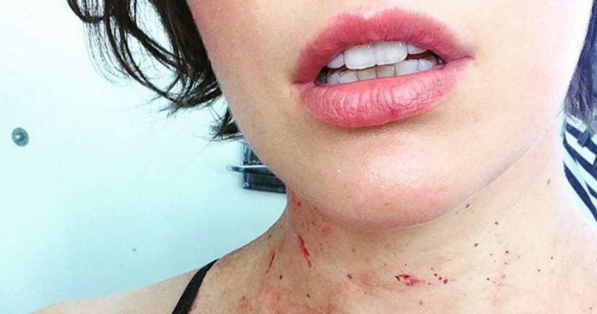 Resident Evil 6 Photo Shows Off Milla Jovovich's Wounds